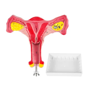 Модель женской матки человека, яичников, Фаллопиевых труб 1:1, Анатомическая модель анатомии человека, учебные пособия